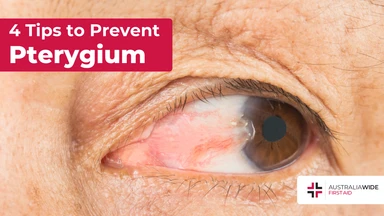 Prevent pterygium article header – First Aid Article in Ballajura